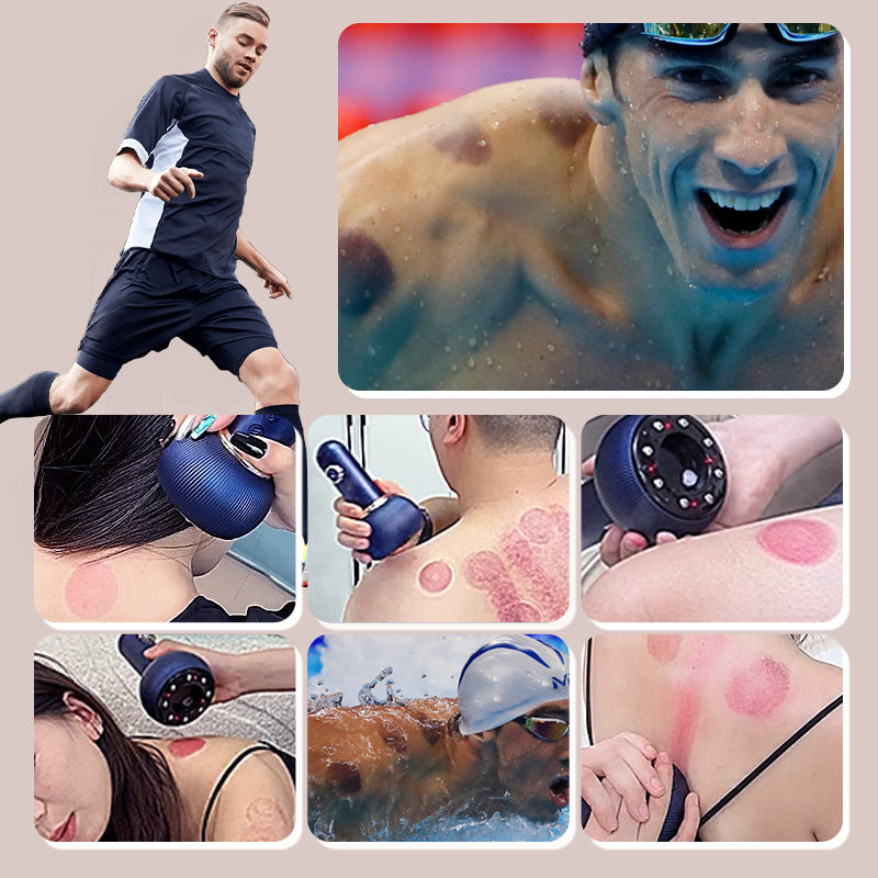 ⏳ Zeitbegrenzte Special⌛ Electric Cupping Therapie Massager & Meridian Pinselset