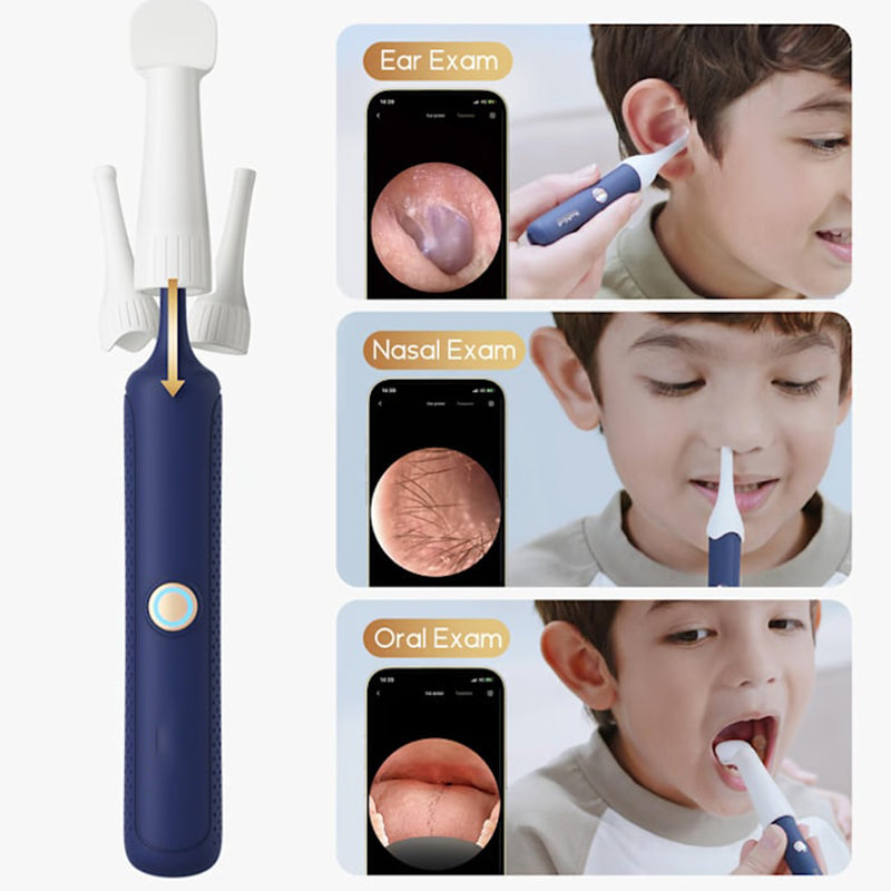 ⏳Begrenzte Zeit 50% Rabatt💥Visuell gebogenes Ohrschmalz-Entfernungsset