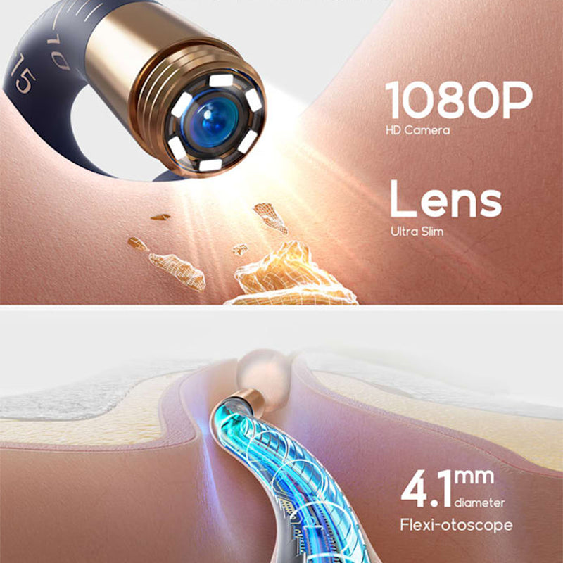 ⏳Begrenzte Zeit 50% Rabatt💥Visuell gebogenes Ohrschmalz-Entfernungsset