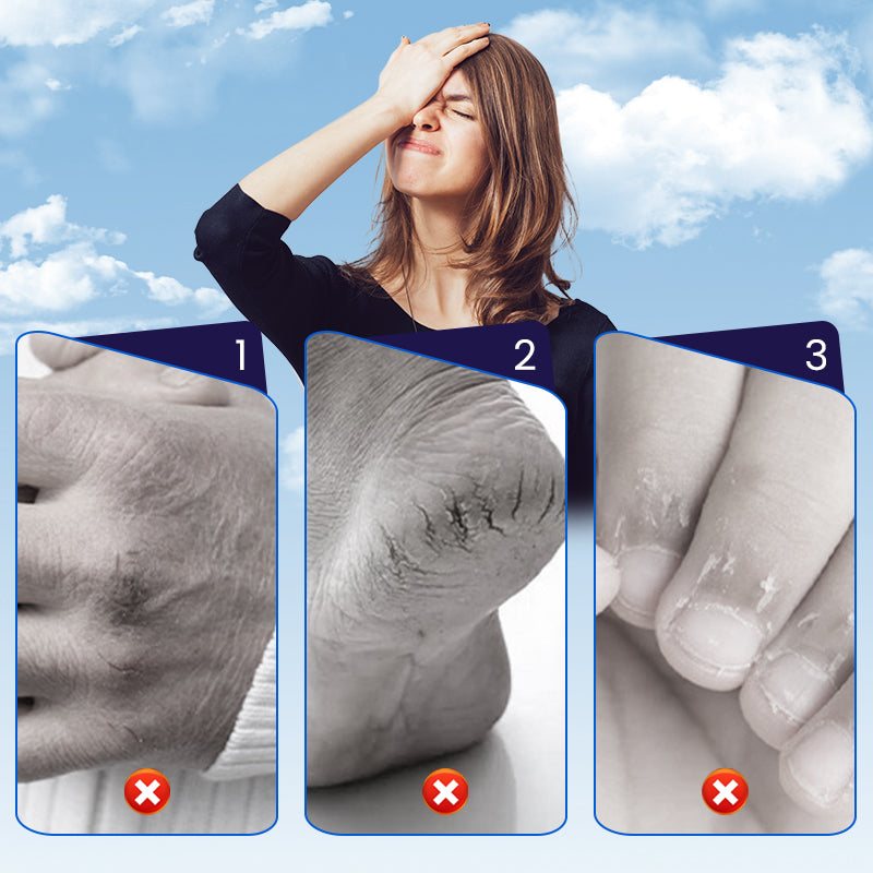 Rissige-Haut-Reparaturpflaster für Hände & Füße (50 % RABATT)