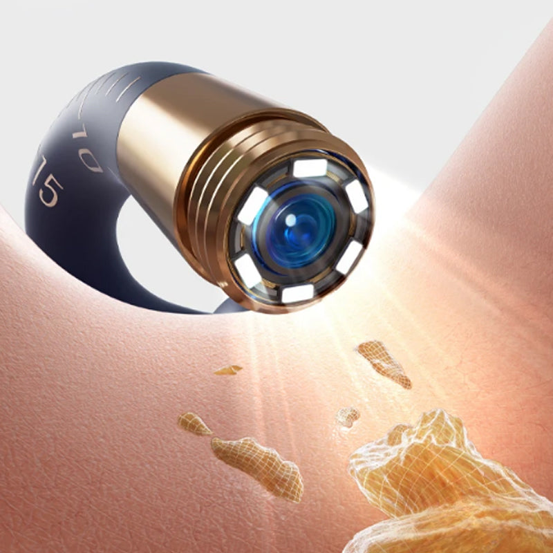 ⏳Begrenzte Zeit 50% Rabatt💥Visuell gebogenes Ohrschmalz-Entfernungsset