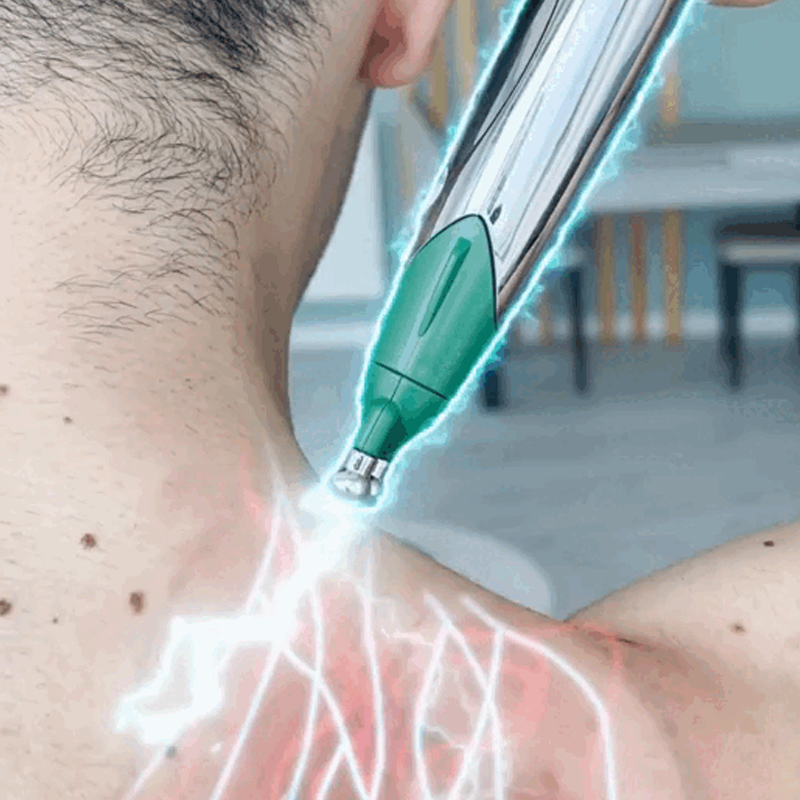 Muskelmassage Therapie Akupunktur Punkt Stift