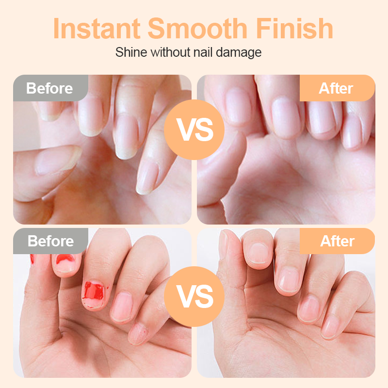 2-in-1 Elektrischer Nagelknipser mit Feilfunktion – sicher & sanft für Babys, Erwachsene und Senioren 👶👵