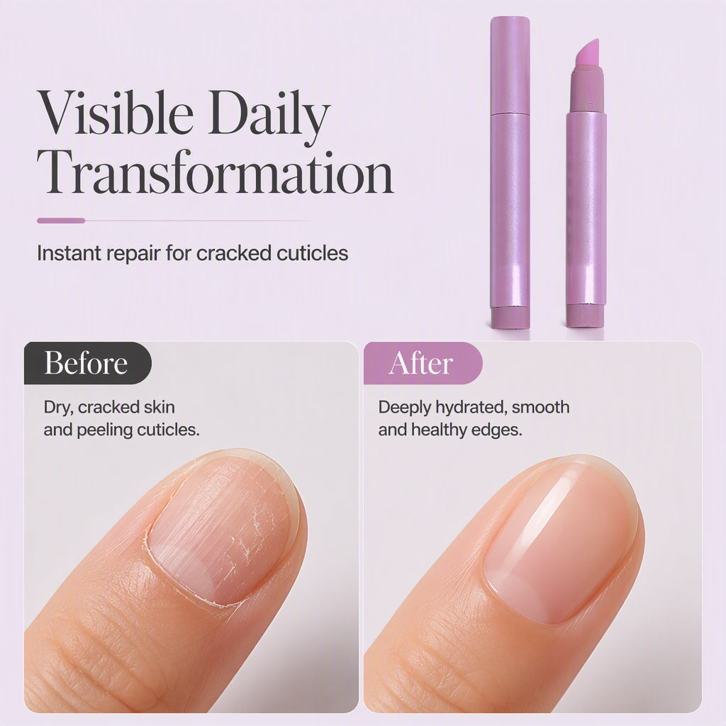 📢📢50% OFF !! ⏰Portable Nail Care Essence Pen